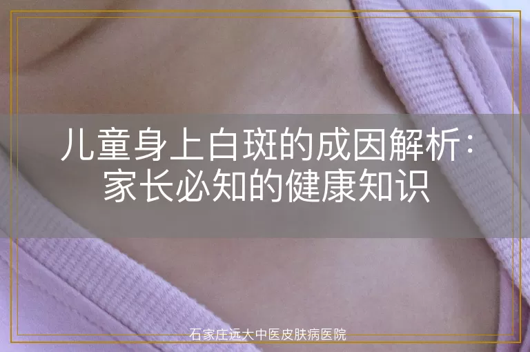 儿童身上白斑的成因解析：家长必知的健康知识