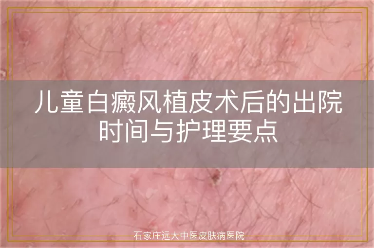 儿童白癜风植皮术后的出院时间与护理要点