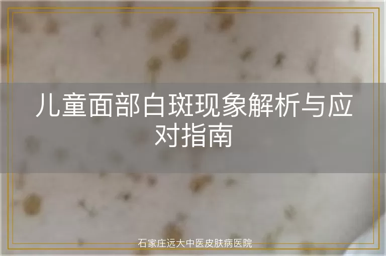 儿童面部白斑现象解析与应对指南