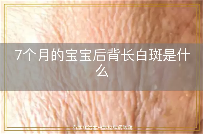 7个月的宝宝后背长白斑是什么