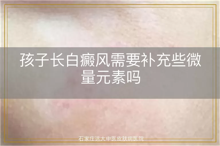 孩子长白癜风需要补充些微量元素吗