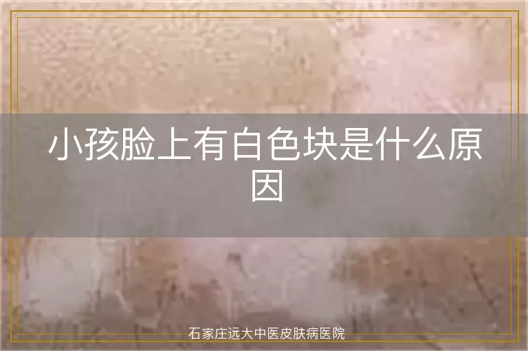 小孩脸上有白色块是什么原因
