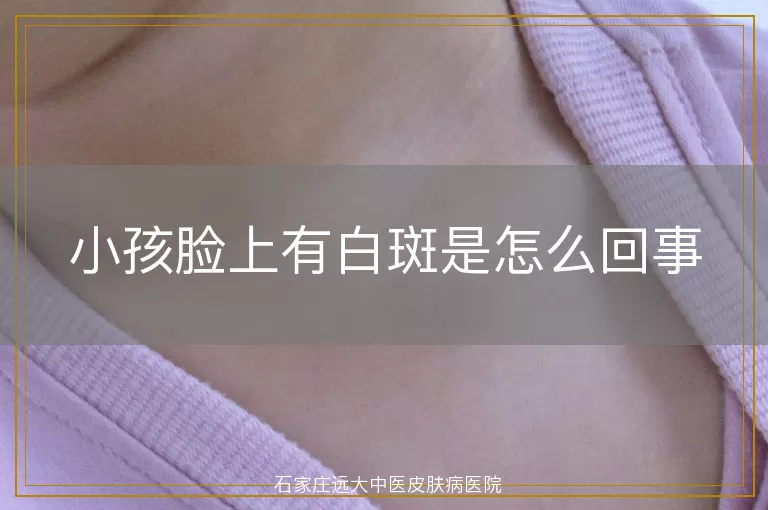 小孩脸上有白斑是怎么回事