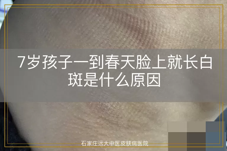 7岁孩子一到春天脸上就长白斑是什么原因