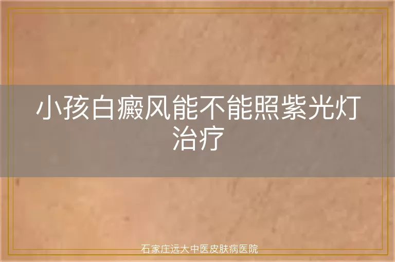 小孩白癜风能不能照紫光灯治疗