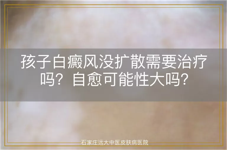 孩子白癜风没扩散需要治疗吗？自愈可能性大吗？