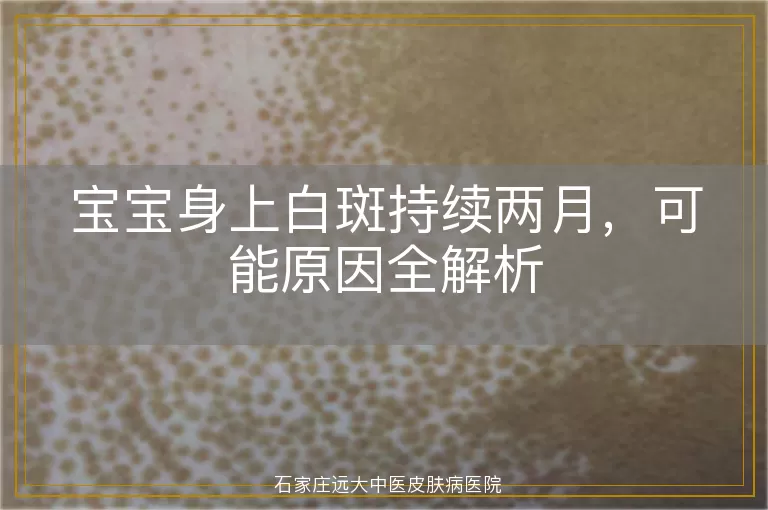 宝宝身上白斑持续两月，可能原因全解析