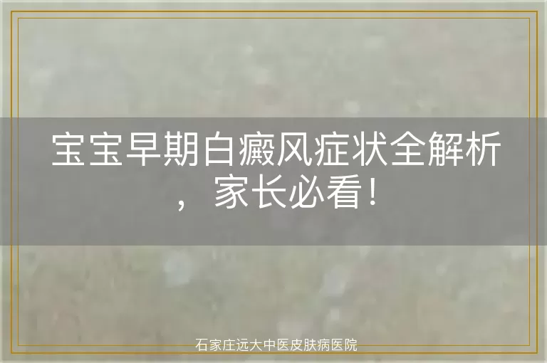 宝宝早期白癜风症状全解析，家长必看！