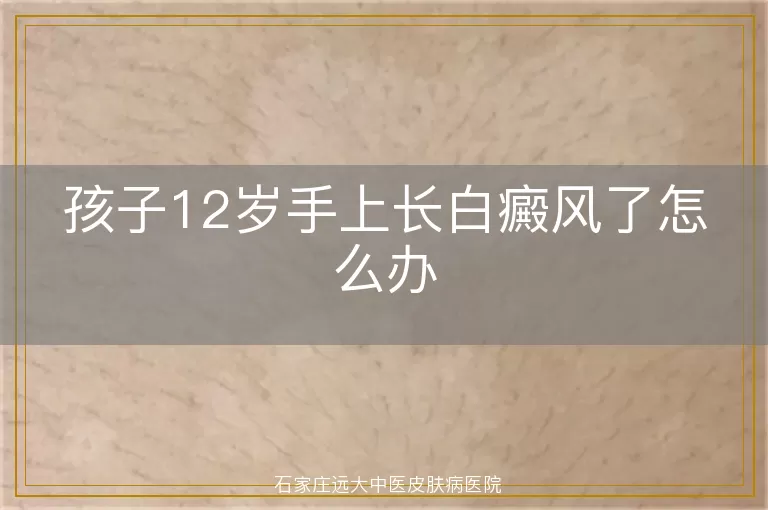 孩子12岁手上长白癜风了怎么办