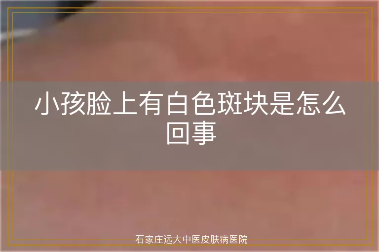 小孩脸上有白色斑块是怎么回事