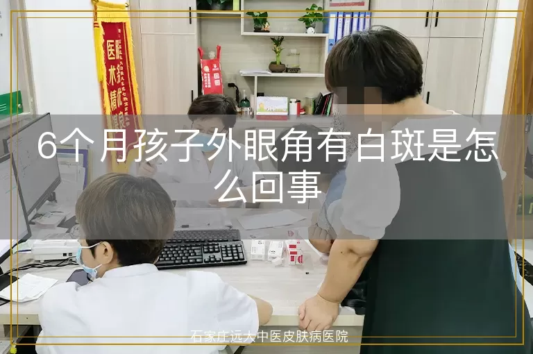 6个月孩子外眼角有白斑是怎么回事