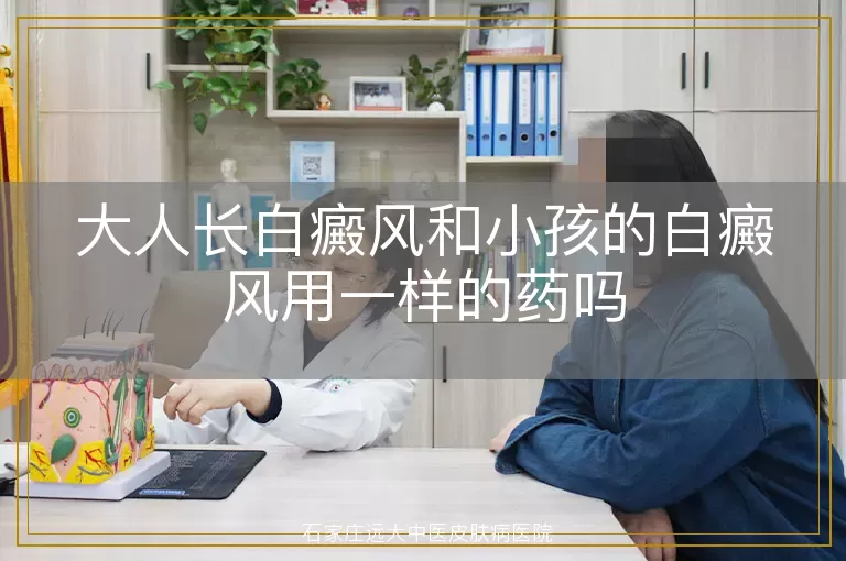 大人长白癜风和小孩的白癜风用一样的药吗
