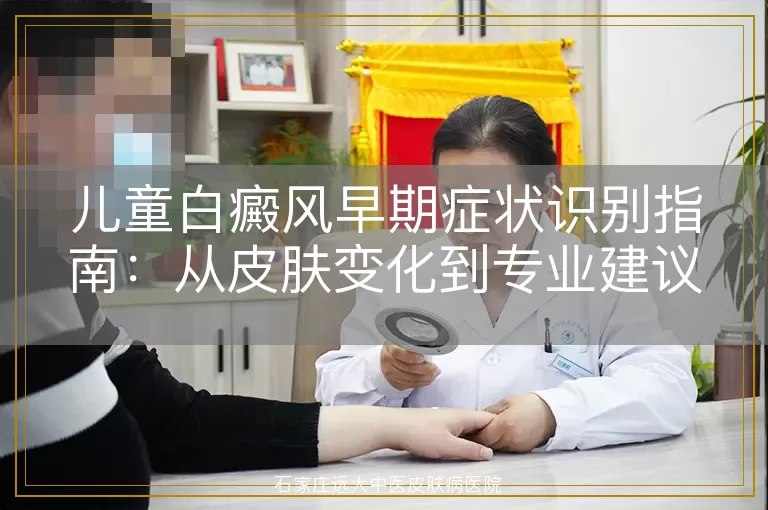 儿童白癜风早期症状识别指南：从皮肤变化到专业建议