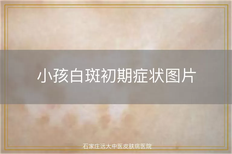 小孩白斑初期症状图片