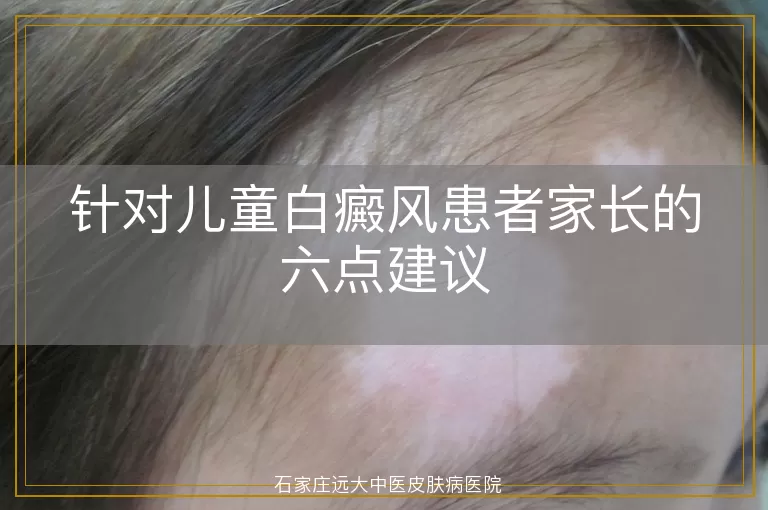 针对儿童白癜风患者家长的六点建议