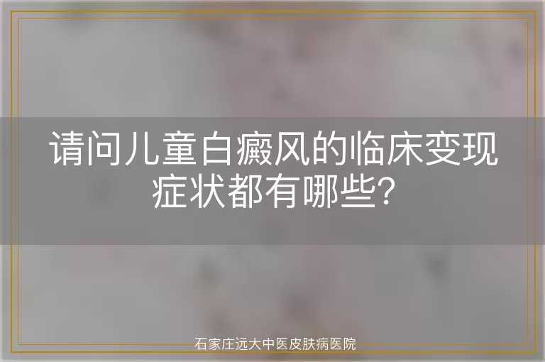 请问儿童白癜风的临床变现症状都有哪些？