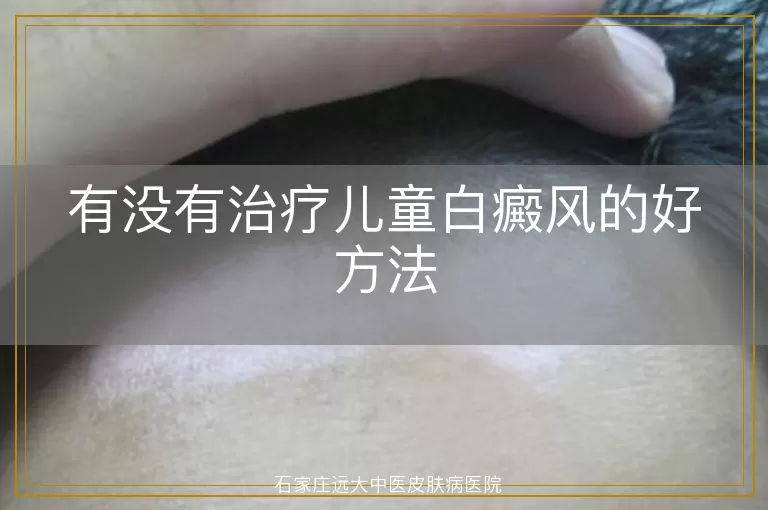 有没有治疗儿童白癜风的好方法