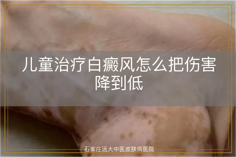 儿童治疗白癜风怎么把伤害降到低
