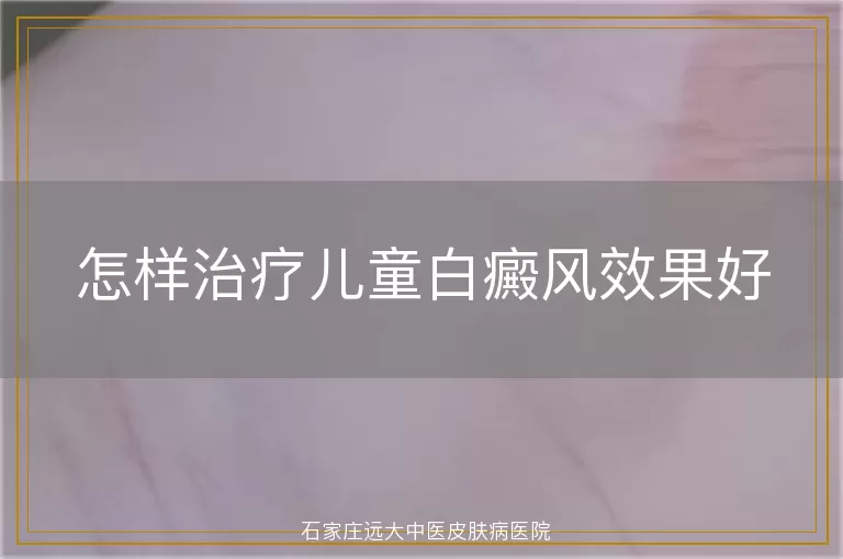 怎样治疗儿童白癜风效果好