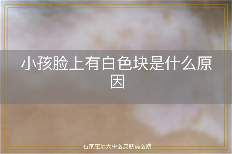 小孩脸上有白色块是什么原因