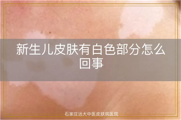 新生儿皮肤有白色部分怎么回事