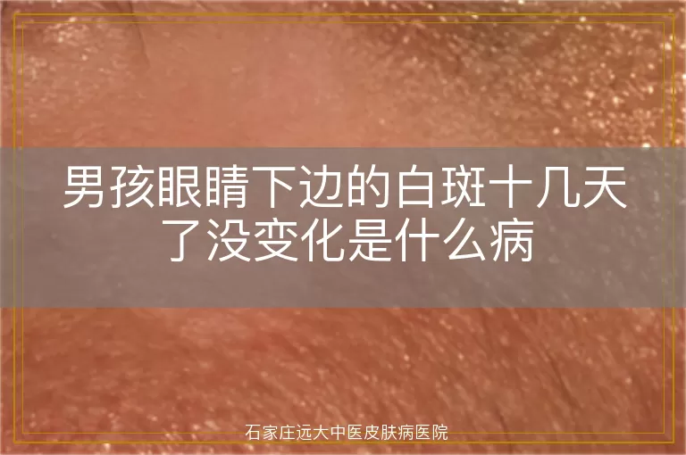 男孩眼睛下边的白斑十几天了没变化是什么病