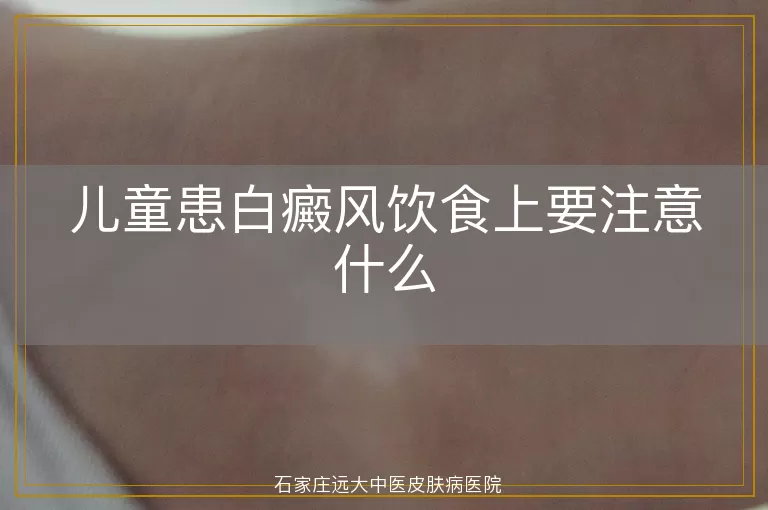 儿童患白癜风饮食上要注意什么