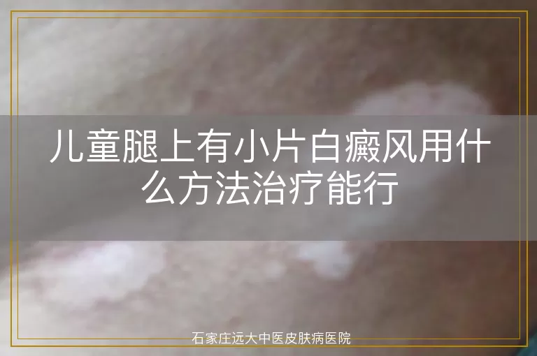 儿童腿上有小片白癜风用什么方法治疗能行
