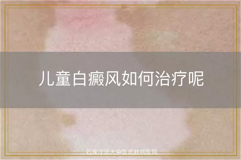 儿童白癜风如何治疗呢