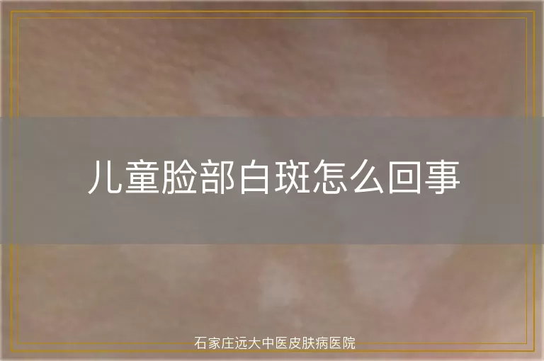 儿童脸部白斑怎么回事