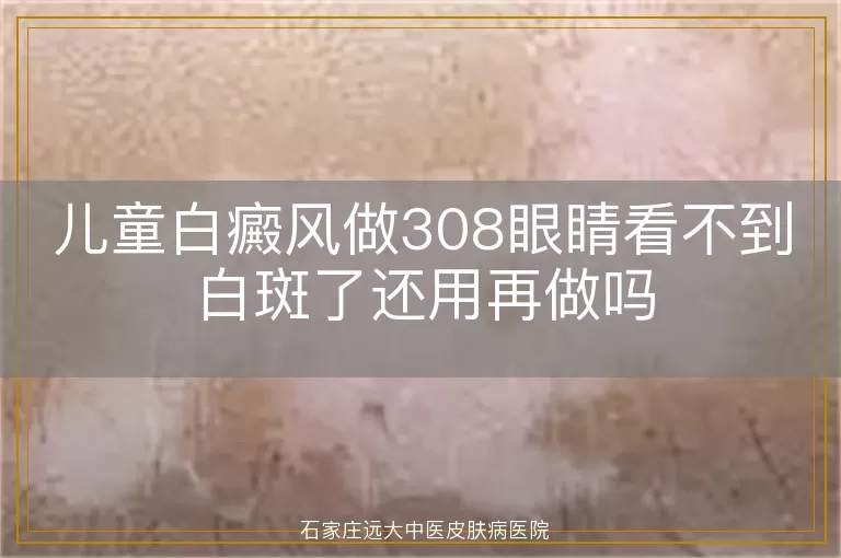 儿童白癜风做308眼睛看不到白斑了还用再做吗