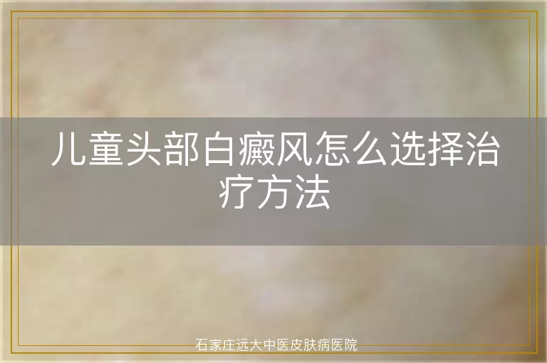 儿童头部白癜风怎么选择治疗方法