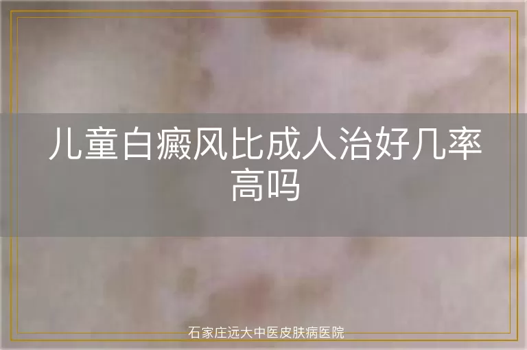 儿童白癜风比成人治好几率高吗