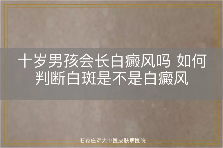 十岁男孩会长白癜风吗 如何判断白斑是不是白癜风
