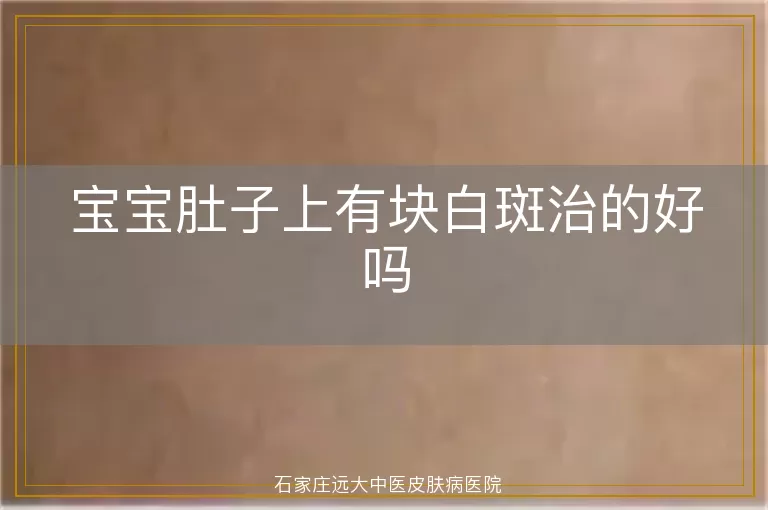 宝宝肚子上有块白斑治的好吗