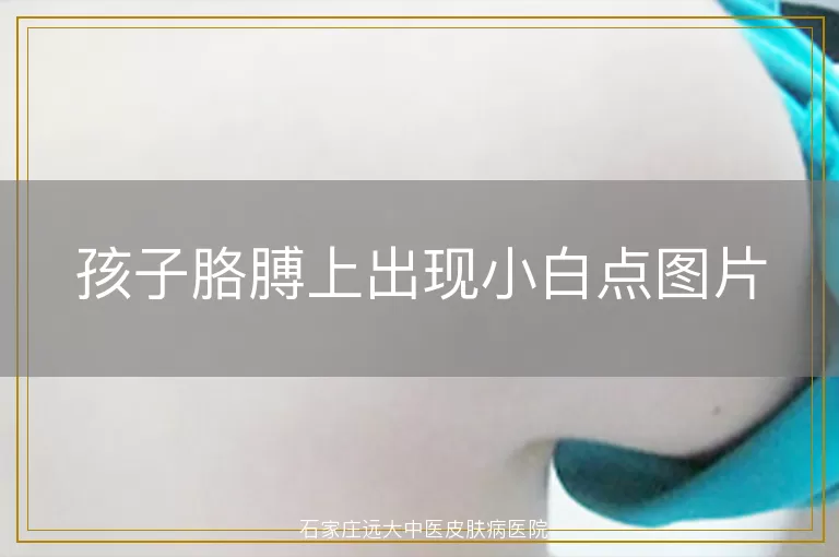 孩子胳膊上出现小白点图片