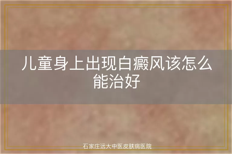 儿童身上出现白癜风该怎么能治好