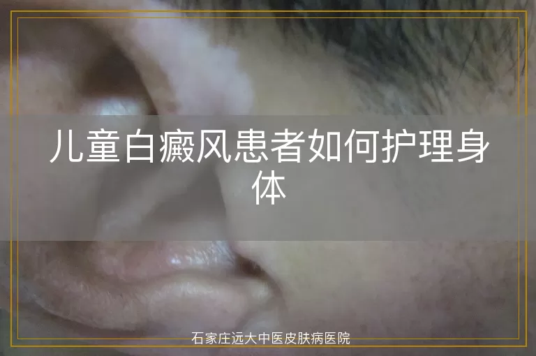 儿童白癜风患者如何护理身体