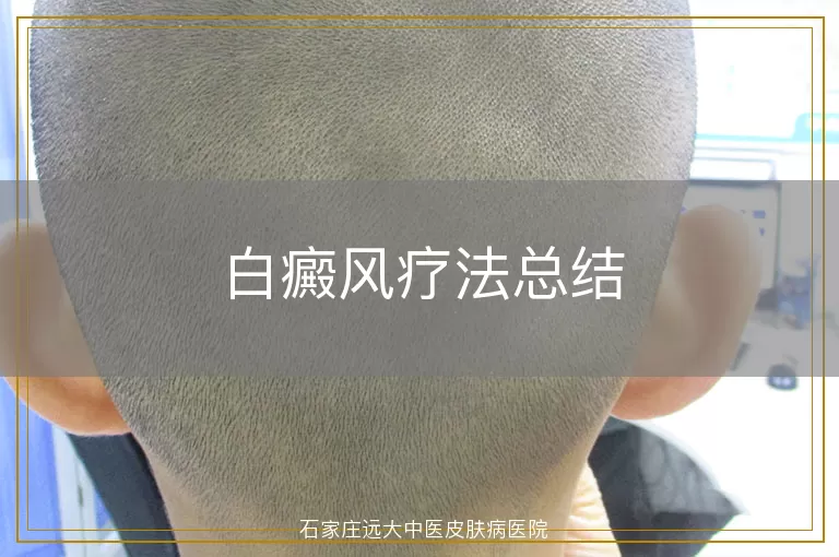 白癜风疗法总结