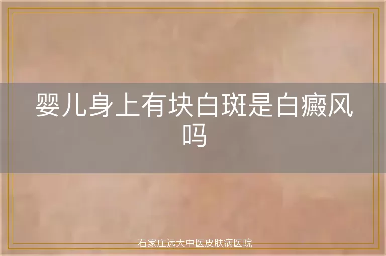 婴儿身上有块白斑是白癜风吗