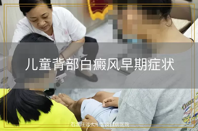 儿童背部白癜风早期症状