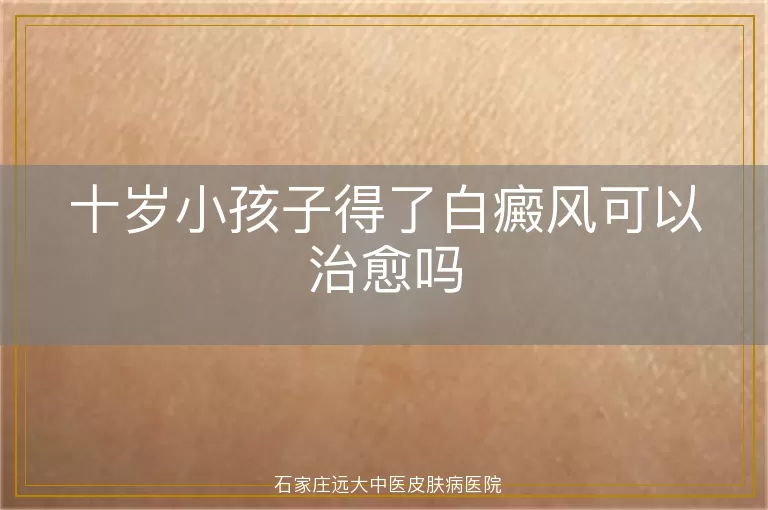 十岁小孩子得了白癜风可以治愈吗
