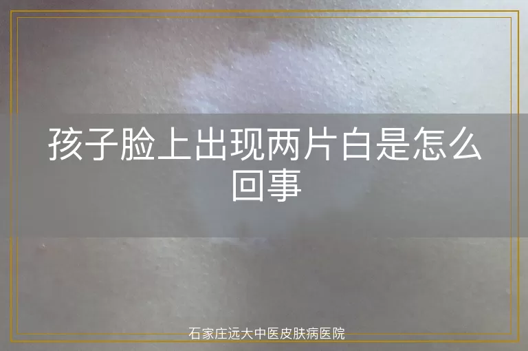 孩子脸上出现两片白是怎么回事