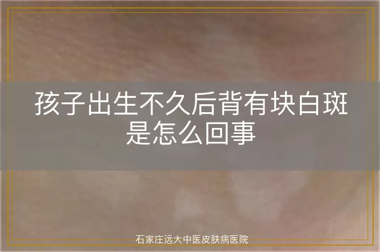 孩子出生不久后背有块白斑是怎么回事