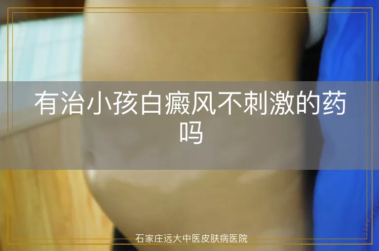 有治小孩白癜风不刺激的药吗