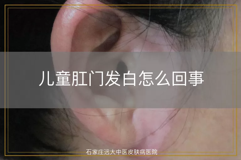 儿童肛门发白怎么回事