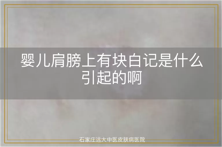 婴儿肩膀上有块白记是什么引起的啊