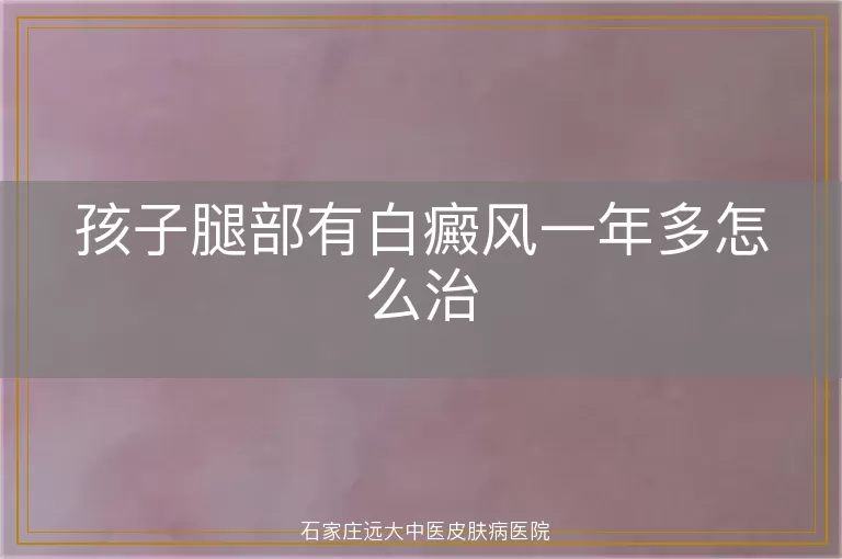 孩子腿部有白癜风一年多怎么治
