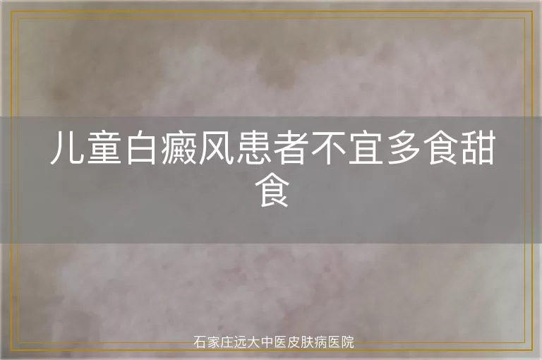 儿童白癜风患者不宜多食甜食
