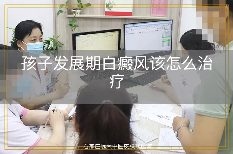 孩子发展期白癜风该怎么治疗